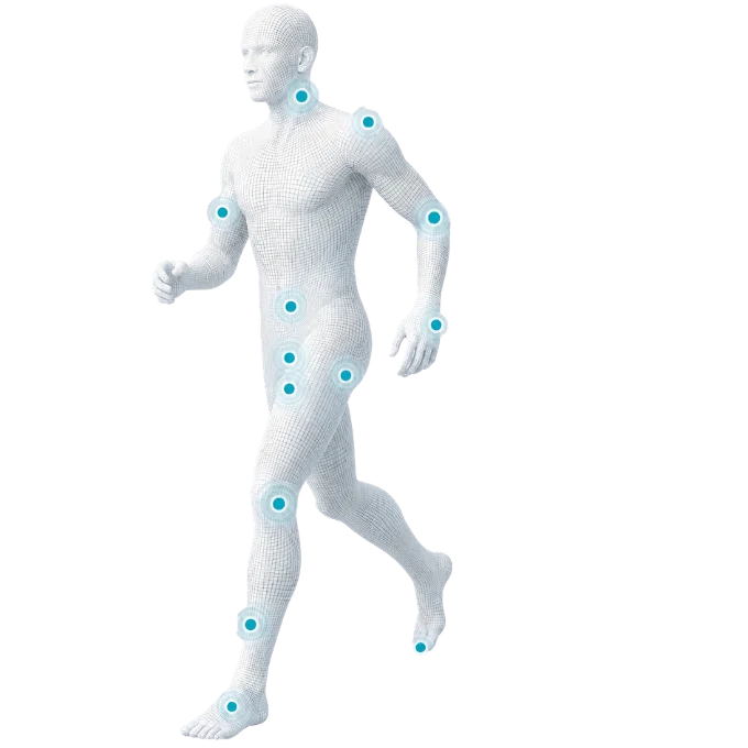 ESWT treatment areas anatomy map showing common shockwave therapy treatment regions